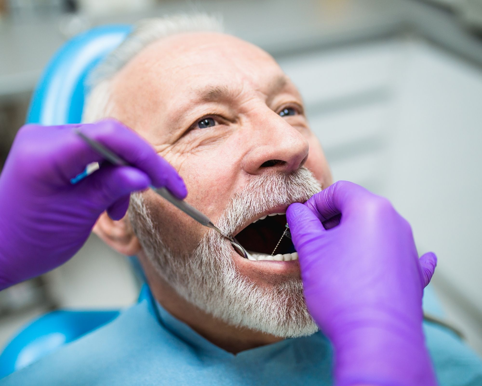 Tips to Look After Your Dental Implants