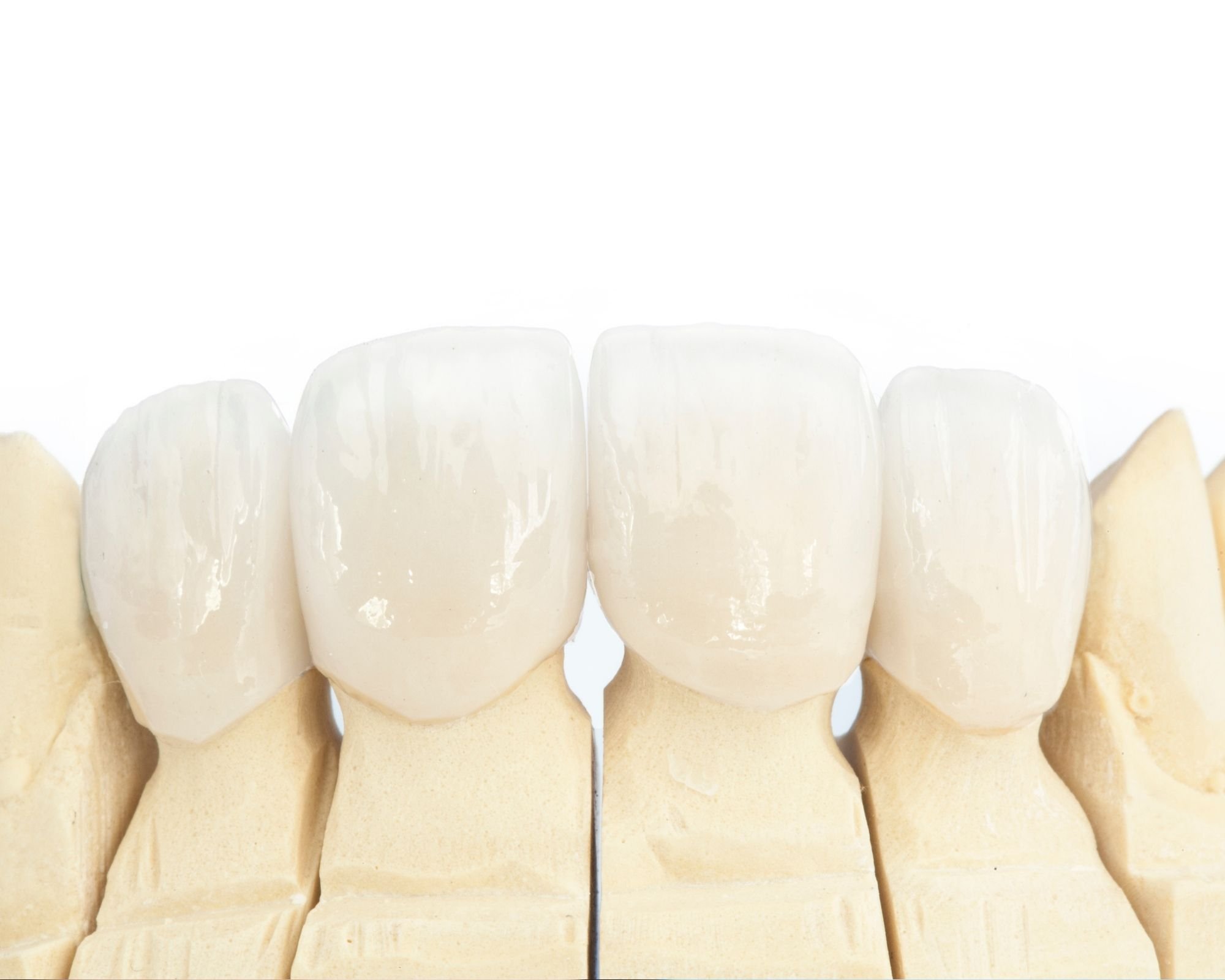 5 Tips from Dental Experts for Taking Care of Your Dental Crown