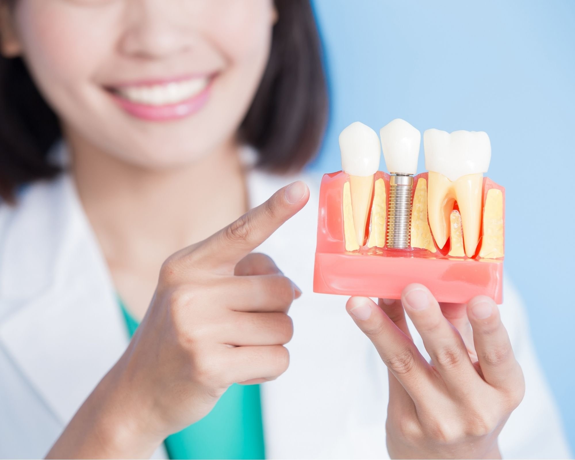 What is the Cost and Procedure for a Single Tooth Dental Implant?