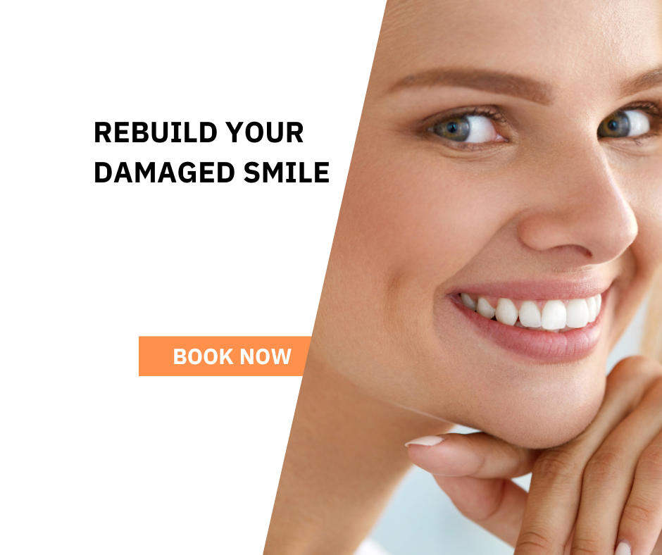 How To Save A Damaged Tooth In Glenroy